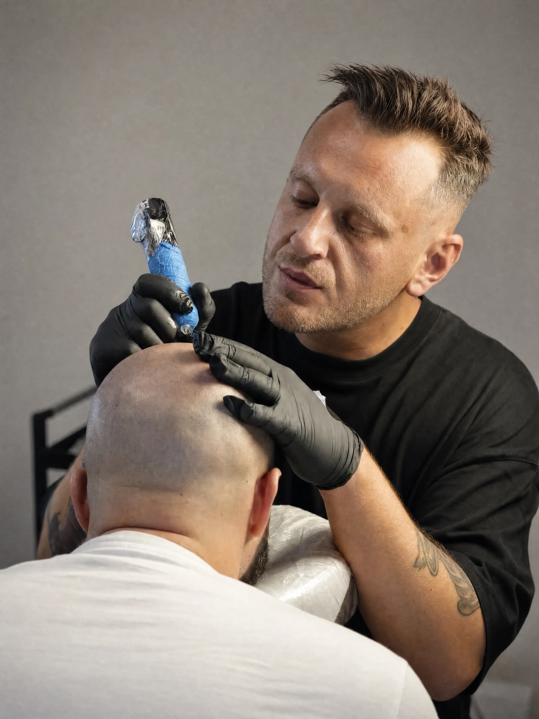 Vaggelis performing scalp micropigmentation in Athens